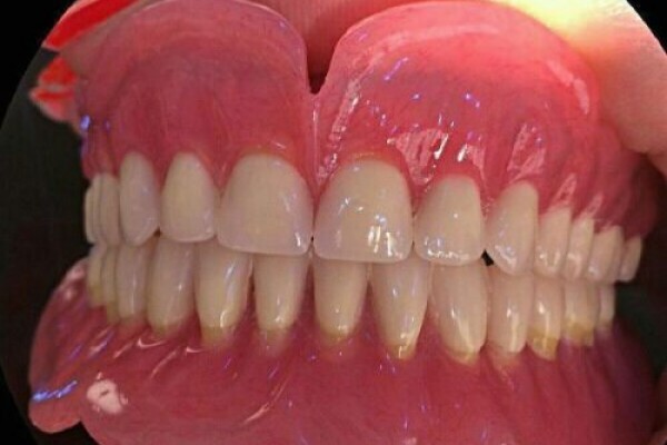 دندانساز ماهر ( متحرک کار ماهر  )